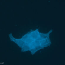 В «Иннова плюс» плюс были успешно получены наноантитела к экстраклеточным доменам рецепторов HER2 и PD-L1 для последующего конъюгирования с радионуклидами и использования в качестве таргетных радиофармпрепаратов для тераностики