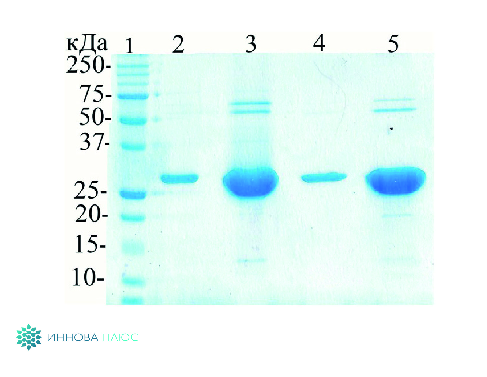 1 – маркер молекулярного веса; 2 – 2 мкг в восстанавливающих условиях; 3 – 40 мкг в восстанавливающих условиях; 4 – 2 мкг в невосстанавливающих условиях; 5 – 40 мкг в невосстанавливающих условиях. 