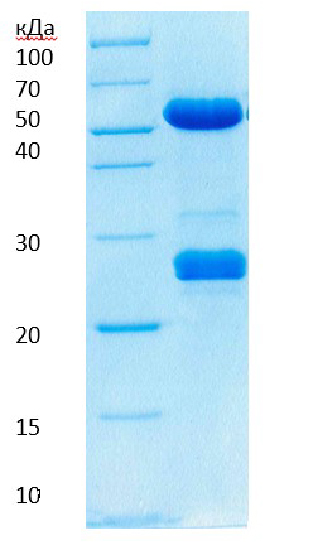 Электрофореграмма поликлональных антител к N белку нуклеокапсида SARS-COV-2