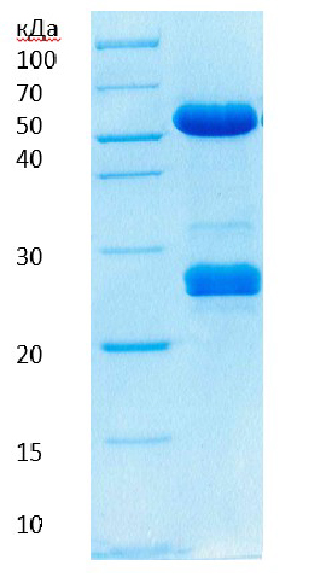Электрофореграмма моноклональных антител
к N белку нуклеокапсида SARS-COV-2