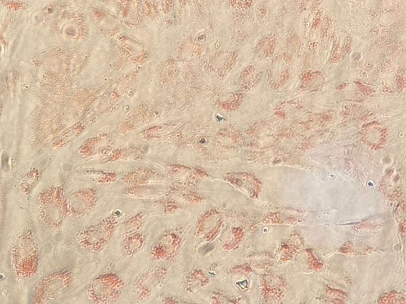 Рисунок 5 – МСК после дифференцировки в адипогенном направлении