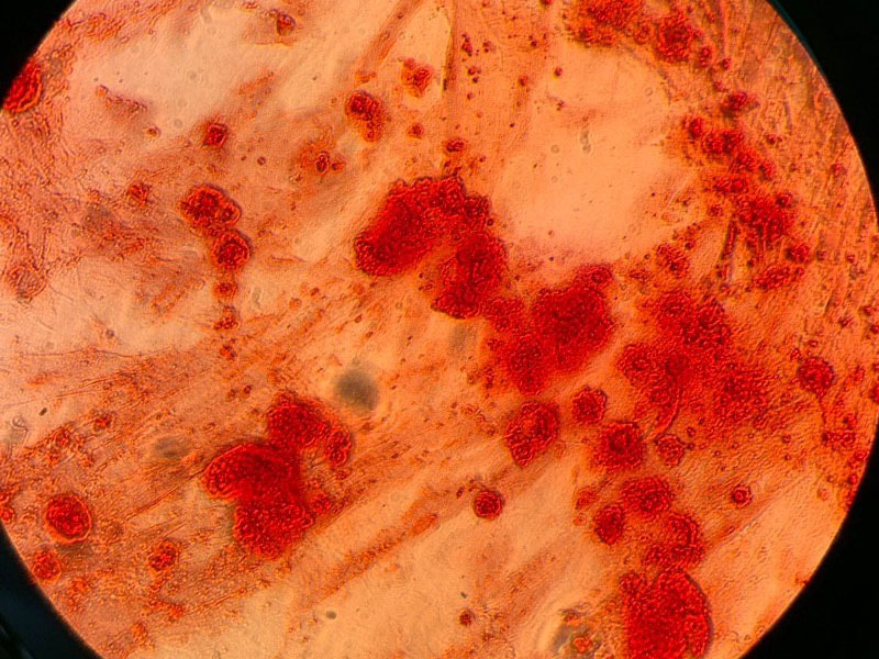 Рисунок 4 – Клетки после остеогенной дифференцировки